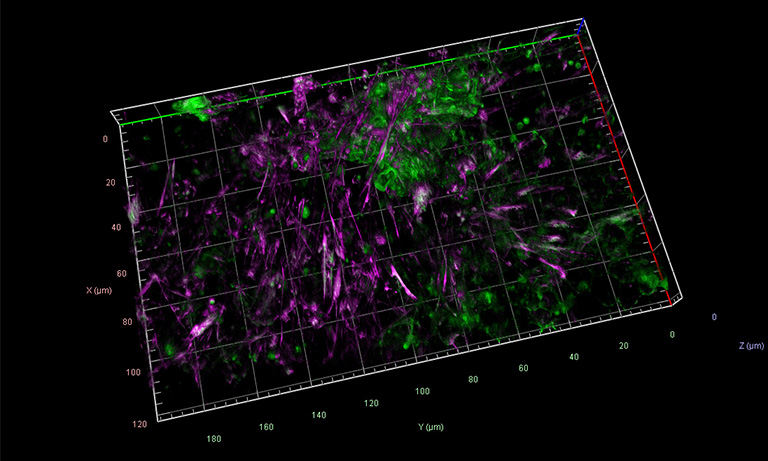 Epithelial cells stained for E-Cadherin and Actin